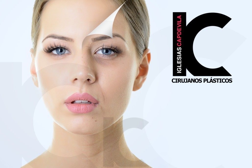 Rejuvenecimiento Facial